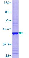 RPP14 Protein - 12.5% SDS-PAGE of human RPP14 stained with Coomassie Blue