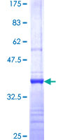 RPP14 Protein - 12.5% SDS-PAGE Stained with Coomassie Blue.