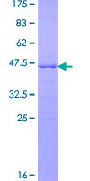 RPP25L / C9orf23 Protein - 12.5% SDS-PAGE of human C9orf23 stained with Coomassie Blue