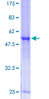 RPP30 Protein - 12.5% SDS-PAGE of human RPP30 stained with Coomassie Blue
