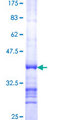 RPP30 Protein - 12.5% SDS-PAGE Stained with Coomassie Blue.