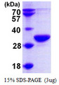 RPP30 Protein