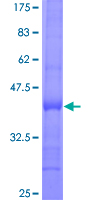 RPP38 Protein - 12.5% SDS-PAGE Stained with Coomassie Blue.