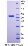 RPP40 / Ribonuclease P Protein - Recombinant Ribonuclease P By SDS-PAGE