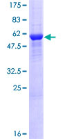 RPRD1A Protein - 12.5% SDS-PAGE of human RPRD1A stained with Coomassie Blue