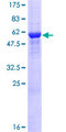 RPRD1A Protein - 12.5% SDS-PAGE of human RPRD1A stained with Coomassie Blue