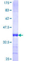 RPRD1A Protein - 12.5% SDS-PAGE Stained with Coomassie Blue.