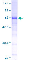 RPRD1B Protein - 12.5% SDS-PAGE of human C20orf77 stained with Coomassie Blue