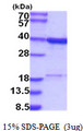 RPRD1B Protein