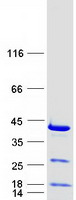 RPRD1B Protein - Purified recombinant protein RPRD1B was analyzed by SDS-PAGE gel and Coomassie Blue Staining