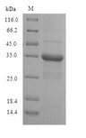 RPS10 / Ribosomal Protein S10 Protein - (Tris-Glycine gel) Discontinuous SDS-PAGE (reduced) with 5% enrichment gel and 15% separation gel.