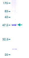 RPS10 / Ribosomal Protein S10 Protein - 12.5% SDS-PAGE of human RPS10 stained with Coomassie Blue