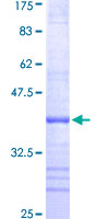 RPS10 / Ribosomal Protein S10 Protein - 12.5% SDS-PAGE Stained with Coomassie Blue.