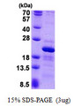 RPS10 / Ribosomal Protein S10 Protein