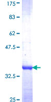 RPS11 / Ribosomal Protein 11 Protein - 12.5% SDS-PAGE Stained with Coomassie Blue.