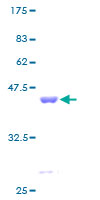 RPS12 / Ribosomal Protein S12 Protein - 12.5% SDS-PAGE of human RPS12 stained with Coomassie Blue