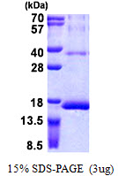 RPS12 / Ribosomal Protein S12 Protein