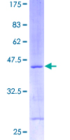 RPS13 / Ribosomal Protein S13 Protein - 12.5% SDS-PAGE of human RPS13 stained with Coomassie Blue