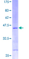 RPS13 / Ribosomal Protein S13 Protein - 12.5% SDS-PAGE of human RPS13 stained with Coomassie Blue