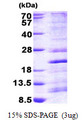 RPS13 / Ribosomal Protein S13 Protein