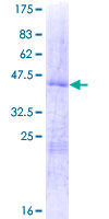 RPS14 / Ribosomal Protein S14 Protein - 12.5% SDS-PAGE of human RPS14 stained with Coomassie Blue