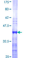 RPS14 / Ribosomal Protein S14 Protein - 12.5% SDS-PAGE Stained with Coomassie Blue.