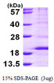 RPS14 / Ribosomal Protein S14 Protein