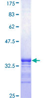 RPS15 / Ribosomal Protein S15 Protein - 12.5% SDS-PAGE Stained with Coomassie Blue.