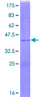 RPS15A Protein - 12.5% SDS-PAGE of human RPS15A stained with Coomassie Blue