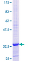 RPS15A Protein - 12.5% SDS-PAGE Stained with Coomassie Blue.