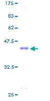 RPS16 / Ribosomal Protein S16 Protein - 12.5% SDS-PAGE of human RPS16 stained with Coomassie Blue