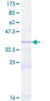RPS16 / Ribosomal Protein S16 Protein - 12.5% SDS-PAGE Stained with Coomassie Blue.