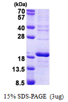 RPS16 / Ribosomal Protein S16 Protein