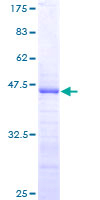 RPS17 / Ribosomal Protein S17 Protein - 12.5% SDS-PAGE of human RPS17 stained with Coomassie Blue
