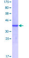 RPS17 / Ribosomal Protein S17 Protein - 12.5% SDS-PAGE Stained with Coomassie Blue.