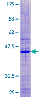 RPS18 / Ribosomal Protein S18 Protein - 12.5% SDS-PAGE of human RPS18 stained with Coomassie Blue
