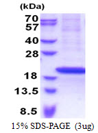 RPS18 / Ribosomal Protein S18 Protein