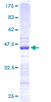 RPS19 / Ribosomal Protein S19 Protein - 12.5% SDS-PAGE of human RPS19 stained with Coomassie Blue