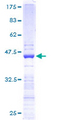 RPS19 / Ribosomal Protein S19 Protein - 12.5% SDS-PAGE of human RPS19 stained with Coomassie Blue