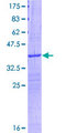 RPS19 / Ribosomal Protein S19 Protein - 12.5% SDS-PAGE Stained with Coomassie Blue.