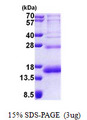 RPS19 / Ribosomal Protein S19 Protein