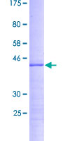 RPS19BP1 Protein - 12.5% SDS-PAGE of human RPS19BP1 stained with Coomassie Blue