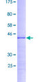 RPS19BP1 Protein - 12.5% SDS-PAGE of human RPS19BP1 stained with Coomassie Blue