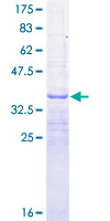 RPS2 / Ribosomal Protein S2 Protein - 12.5% SDS-PAGE Stained with Coomassie Blue.