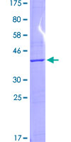 RPS2 / Ribosomal Protein S2 Protein - 12.5% SDS-PAGE Stained with Coomassie Blue.