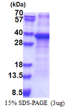 RPS2 / Ribosomal Protein S2 Protein