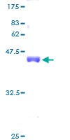 RPS20 / Ribosomal Protein S20 Protein - 12.5% SDS-PAGE of human RPS20 stained with Coomassie Blue