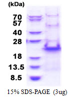 RPS20 / Ribosomal Protein S20 Protein