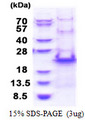 RPS20 / Ribosomal Protein S20 Protein