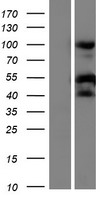 RPS21 / Ribosomal Protein S21 Protein - Western validation with an anti-DDK antibody * L: Control HEK293 lysate R: Over-expression lysate